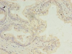 Invitrogen SSR3 Polyclonal Antibody 100 &mu;g | Buy Online | Invitrogen&trade; | Fisher Scientific