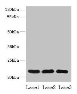 Invitrogen SSR3 Polyclonal Antibody 100 &mu;g | Buy Online | Invitrogen&trade; | Fisher Scientific