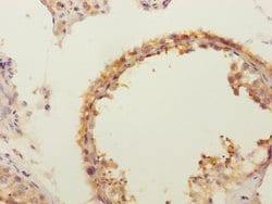 Invitrogen FLVCR2 Polyclonal Antibody 100 &mu;L; Unconjugated:Antibodies,