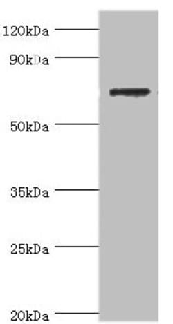 Invitrogen SLC25A13 Polyclonal Antibody 100 &mu;L; Unconjugated:Antibodies,