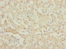 Invitrogen MYO5B Polyclonal Antibody 100 &mu;L; Unconjugated:Antibodies,