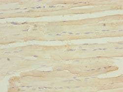 Invitrogen MYO5B Polyclonal Antibody 100 &mu;L; Unconjugated:Antibodies,