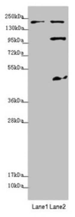 Invitrogen MYO5B Polyclonal Antibody 100 &mu;L; Unconjugated:Antibodies,