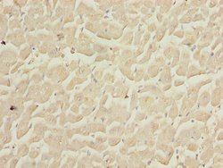 COPS3 Polyclonal Antibody:Antibodies, Polyclonal