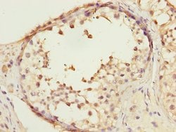 COPS3 Polyclonal Antibody:Antibodies, Polyclonal