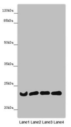 Invitrogen B9D1 Polyclonal Antibody 100 &mu;L; Unconjugated:Antibodies,