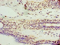 Invitrogen AP1M2 Polyclonal Antibody 100 &mu;L; Unconjugated:Antibodies,