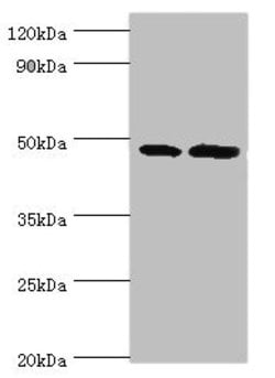 Invitrogen AP1M2 Polyclonal Antibody 100 &mu;L; Unconjugated:Antibodies,