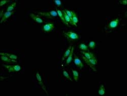 Invitrogen PADI2 Polyclonal Antibody 100 &mu;g; Unconjugated:Antibodies,