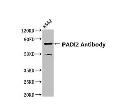 Invitrogen PADI2 Polyclonal Antibody 100 &mu;g; Unconjugated:Antibodies,