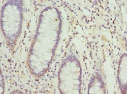 Invitrogen NFS1 Polyclonal Antibody 100 &mu;L | Buy Online | Invitrogen&trade; | Fisher Scientific