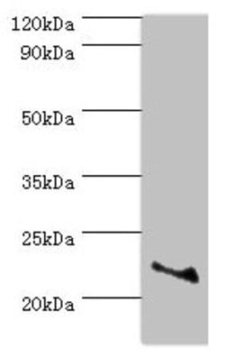 Invitrogen ASF1A Polyclonal Antibody 100 &mu;L; Unconjugated:Antibodies,