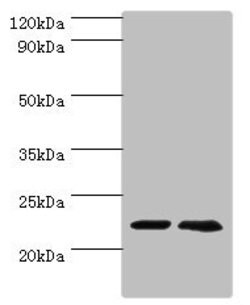 Invitrogen ASF1A Polyclonal Antibody 100 &mu;L | Buy Online | Invitrogen&trade; | Fisher Scientific