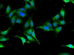 Invitrogen SEC23IP Polyclonal Antibody 100 &mu;g; Unconjugated:Antibodies,