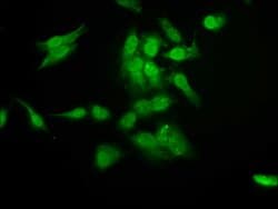 Invitrogen RAD54L2 Polyclonal Antibody 100 &mu;g; Unconjugated:Antibodies,