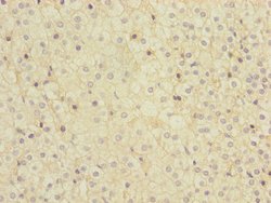 Invitrogen MMACHC Polyclonal Antibody 100 &mu;L; Unconjugated:Antibodies,