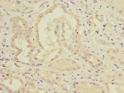 Invitrogen MMACHC Polyclonal Antibody 100 &mu;L; Unconjugated:Antibodies,