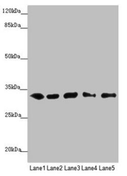 Invitrogen MMACHC Polyclonal Antibody 100 &mu;L; Unconjugated:Antibodies,