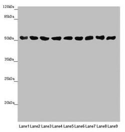 Invitrogen SAMM50 Polyclonal Antibody 100 &mu;L; Unconjugated:Antibodies,