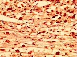 Invitrogen LRRFIP2 Polyclonal Antibody 100 &mu;g; Unconjugated:Antibodies,