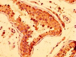 Invitrogen LRRFIP2 Polyclonal Antibody 100 &mu;g; Unconjugated:Antibodies,