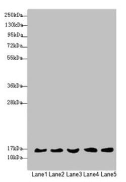 Invitrogen MRPS16 Polyclonal Antibody 100 &mu;L; Unconjugated:Antibodies,