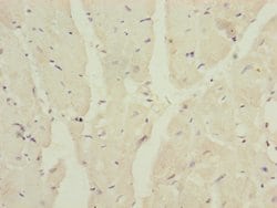 Invitrogen MRPS16 Polyclonal Antibody 100 &mu;L | Buy Online | Invitrogen&trade; | Fisher Scientific