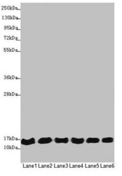 Invitrogen MRPS16 Polyclonal Antibody 100 &mu;L | Buy Online | Invitrogen&trade; | Fisher Scientific