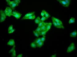 Invitrogen LAS1L Polyclonal Antibody 100 &mu;g; Unconjugated:Antibodies,