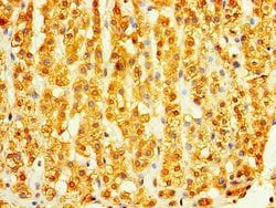 Invitrogen DHRS7 Polyclonal Antibody 100 &mu;g; Unconjugated:Antibodies,