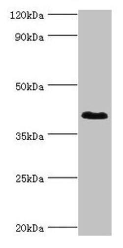 Invitrogen DHRS7 Polyclonal Antibody 100 &mu;g; Unconjugated:Antibodies,