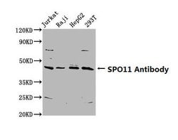 Invitrogen SPO11 Polyclonal Antibody 100 &mu;g; Unconjugated:Antibodies,