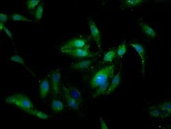 Invitrogen SSX2IP Polyclonal Antibody 100 &mu;g; Unconjugated:Antibodies,