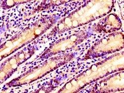 Invitrogen SSX2IP Polyclonal Antibody 100 &mu;g; Unconjugated:Antibodies,