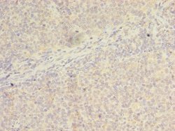 Invitrogen WDR37 Polyclonal Antibody 100 &mu;g; Unconjugated:Antibodies,