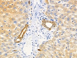Phospho-EphA2/EphA3/EphA4 (Tyr588, Tyr596) Polyclonal Antibody, Invitrogen