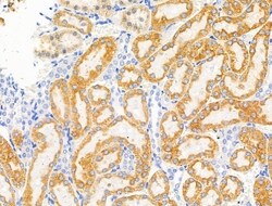 Phospho-EphA2/EphA3/EphA4 (Tyr588, Tyr596) Polyclonal Antibody, Invitrogen