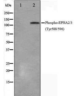 Phospho-EphA2/EphA3/EphA4 (Tyr588, Tyr596) Polyclonal Antibody, Invitrogen