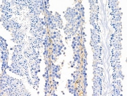 Invitrogen Phospho-eNOS (Ser615) Polyclonal Antibody 100 &mu;L; Unconjugated:Antibodies,