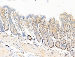 Invitrogen Phospho-eNOS (Ser615) Polyclonal Antibody 100 &mu;L; Unconjugated:Antibodies,
