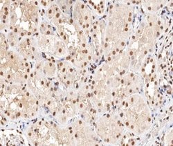 Invitrogen Phospho-PRAK (Thr182) Polyclonal Antibody 100 &mu;L; Unconjugated:Antibodies,
