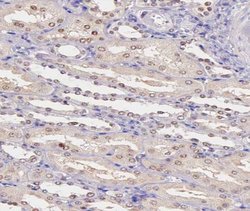 Invitrogen Phospho-PRAK (Thr182) Polyclonal Antibody 100 &mu;L; Unconjugated:Antibodies,