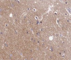 Invitrogen GNAZ Polyclonal Antibody 100 &mu;L; Unconjugated:Antibodies,