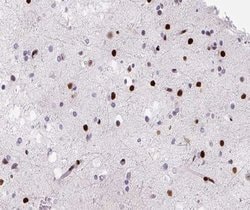 hnRNP D Polyclonal Antibody:Antibodies, Polyclonal