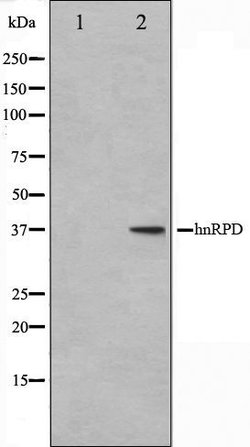 hnRNP D Polyclonal Antibody:Antibodies, Polyclonal