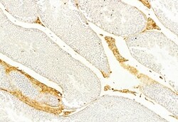 Invitrogen Collagen III Polyclonal Antibody 100 &mu;L; Unconjugated:Antibodies,