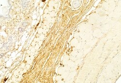 Invitrogen Collagen III Polyclonal Antibody 100 &mu;L; Unconjugated:Antibodies,