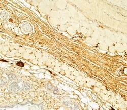 Invitrogen Collagen III Polyclonal Antibody 100 &mu;L; Unconjugated:Antibodies,