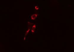 Invitrogen Collagen III Polyclonal Antibody 100 &mu;L; Unconjugated:Antibodies,