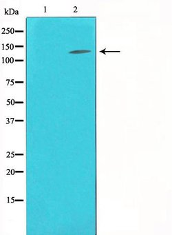 Invitrogen Collagen III Polyclonal Antibody 100 &mu;L; Unconjugated:Antibodies,
